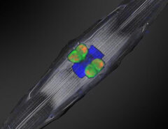 Die den Rhizobien-zugehörigen stickstofffixierenden Symbionten (mit fluoreszierenden Gensonden markiert in orange und grün) befinden sich innerhalb von Kieselalgen, die im tropischen Nordatlantik gesammelt wurden. Der Zellkern der Kieselalge ist in blau zu sehen.