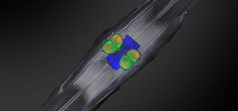 Die den Rhizobien-zugehörigen stickstofffixierenden Symbionten (mit fluoreszierenden Gensonden markiert in orange und grün) befinden sich innerhalb von Kieselalgen, die im tropischen Nordatlantik gesammelt wurden. Der Zellkern der Kieselalge ist in blau zu sehen.